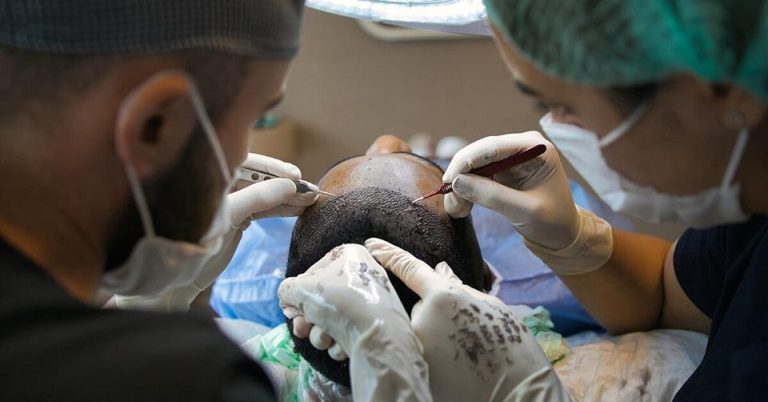 Over ons Zantman haartransplantatie procedure: donorgebied en transplantatie van gezonde haarfollikels